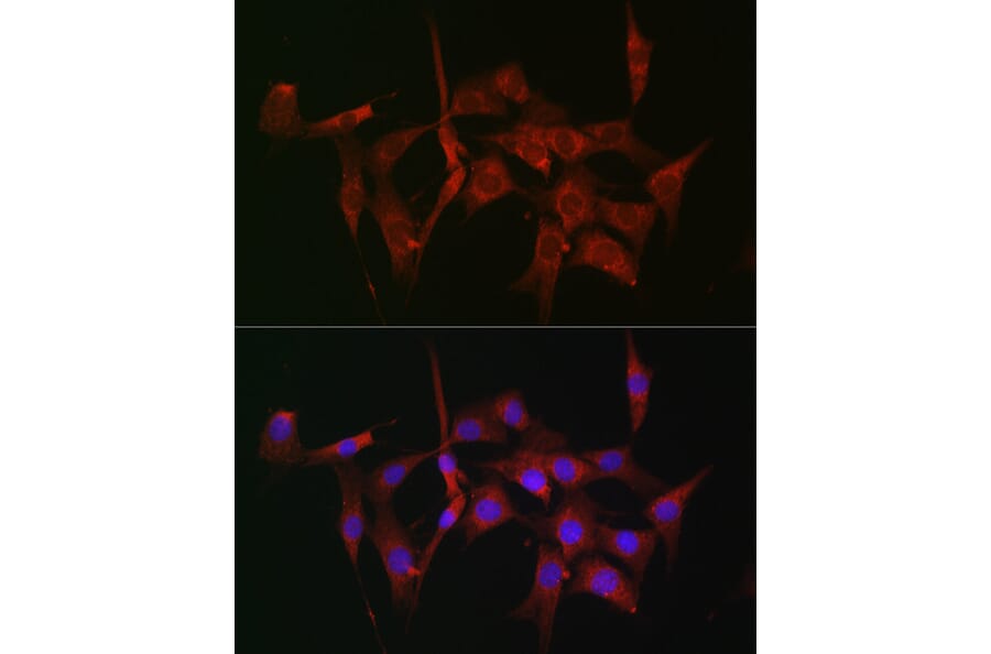 Immunofluorescence - Anti-Fascin Antibody (A13733) - Antibodies.com