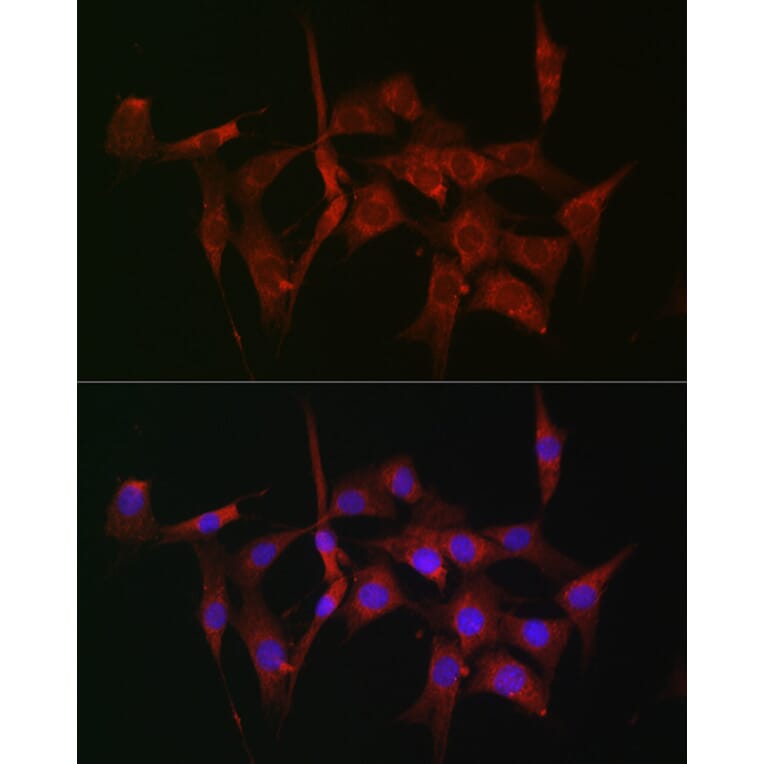 Immunofluorescence - Anti-Fascin Antibody (A13733) - Antibodies.com