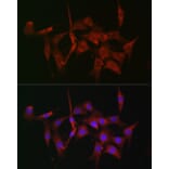 Immunofluorescence - Anti-Fascin Antibody (A13733) - Antibodies.com