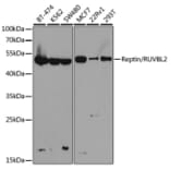 Western Blot - Anti-Reptin / TIP49B / RUVB2 Antibody (A13734) - Antibodies.com