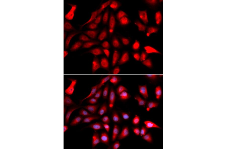 Immunofluorescence - Anti-Reptin / TIP49B / RUVB2 Antibody (A13734) - Antibodies.com