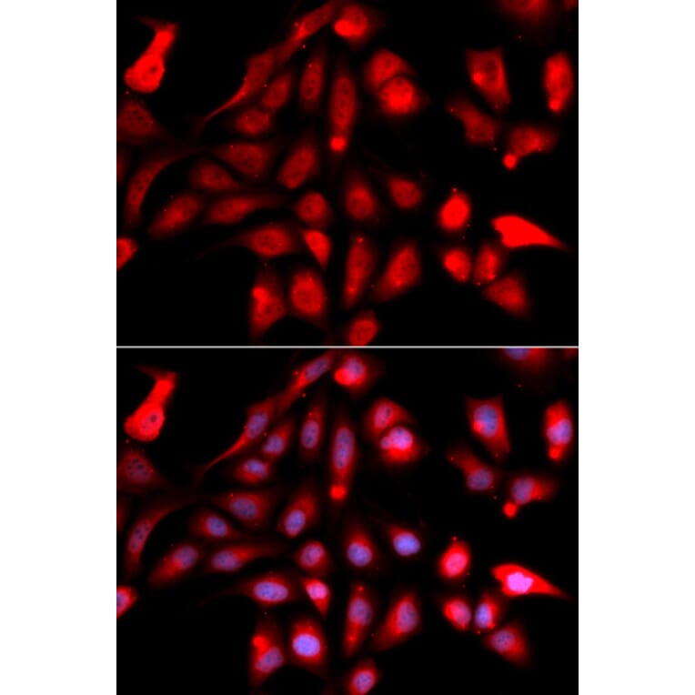 Immunofluorescence - Anti-Reptin / TIP49B / RUVB2 Antibody (A13734) - Antibodies.com