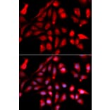 Immunofluorescence - Anti-Reptin / TIP49B / RUVB2 Antibody (A13734) - Antibodies.com