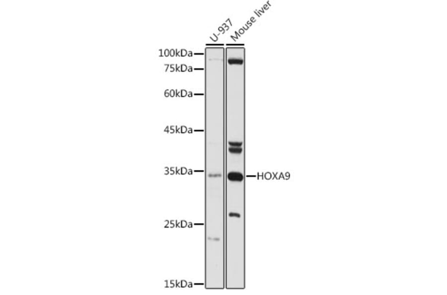 Western Blot - Anti-HOXA9 Antibody (A13735) - Antibodies.com