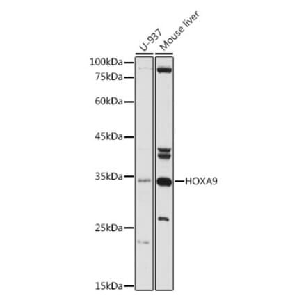 Western Blot - Anti-HOXA9 Antibody (A13735) - Antibodies.com