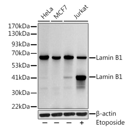 Western Blot - Anti-Lamin B1 Antibody (A13736) - Antibodies.com