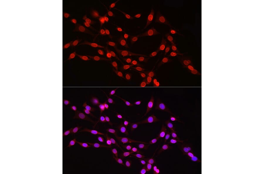 Immunofluorescence - Anti-Lamin B1 Antibody (A13736) - Antibodies.com