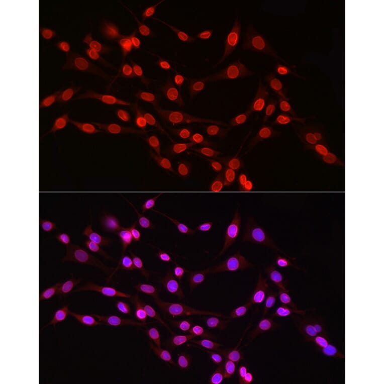 Immunofluorescence - Anti-Lamin B1 Antibody (A13736) - Antibodies.com