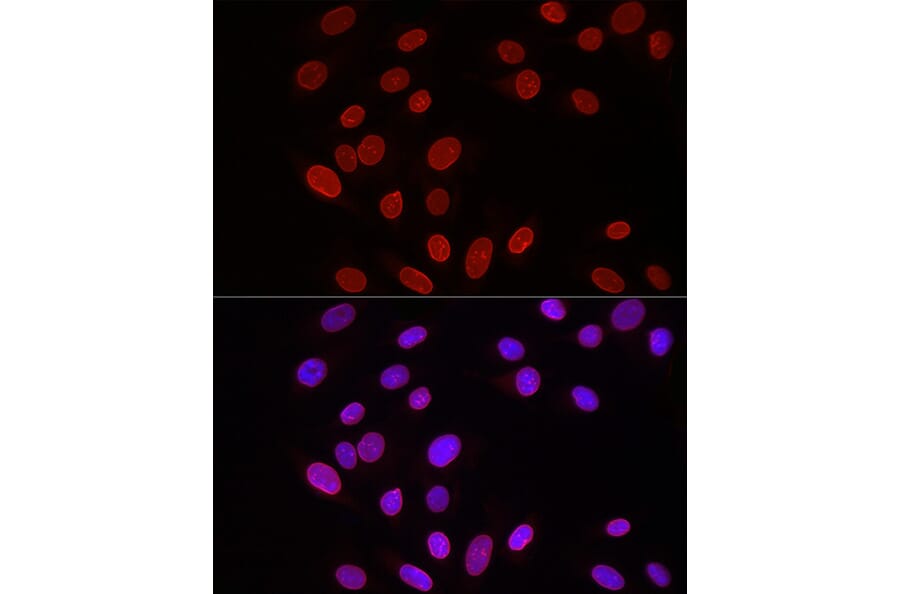 Immunofluorescence - Anti-Lamin B1 Antibody (A13736) - Antibodies.com