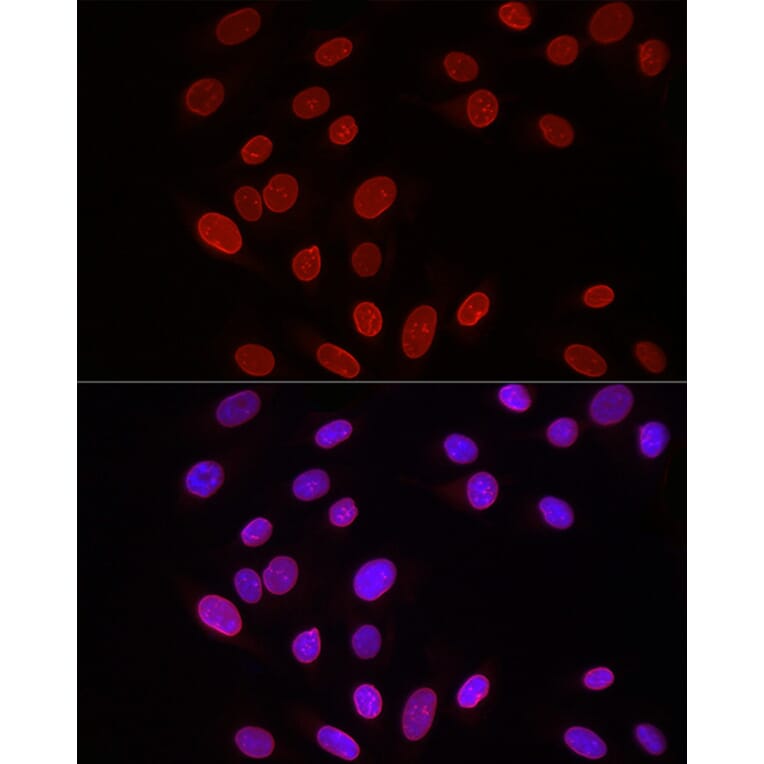 Immunofluorescence - Anti-Lamin B1 Antibody (A13736) - Antibodies.com