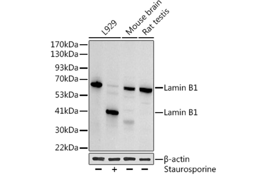Western Blot - Anti-Lamin B1 Antibody (A13736) - Antibodies.com