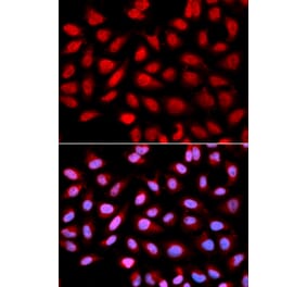 Immunofluorescence - Anti-PPP2R4 Antibody (A13737) - Antibodies.com