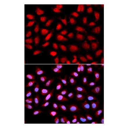 Immunofluorescence - Anti-PPP2R4 Antibody (A13737) - Antibodies.com