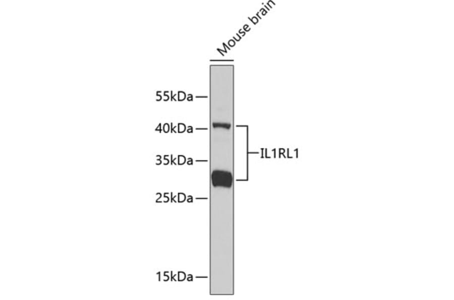 Western Blot - Anti-ST2 Antibody (A13738) - Antibodies.com