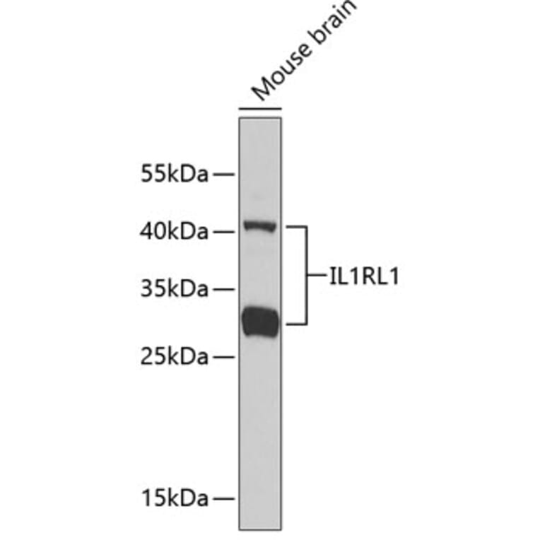 Western Blot - Anti-ST2 Antibody (A13738) - Antibodies.com