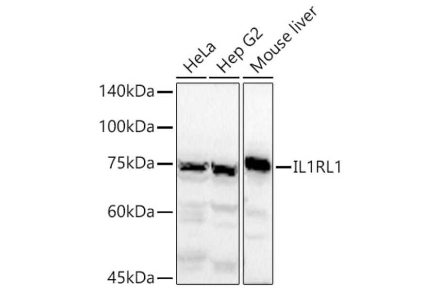 Western Blot - Anti-ST2 Antibody (A13738) - Antibodies.com
