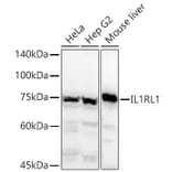 Western Blot - Anti-ST2 Antibody (A13738) - Antibodies.com
