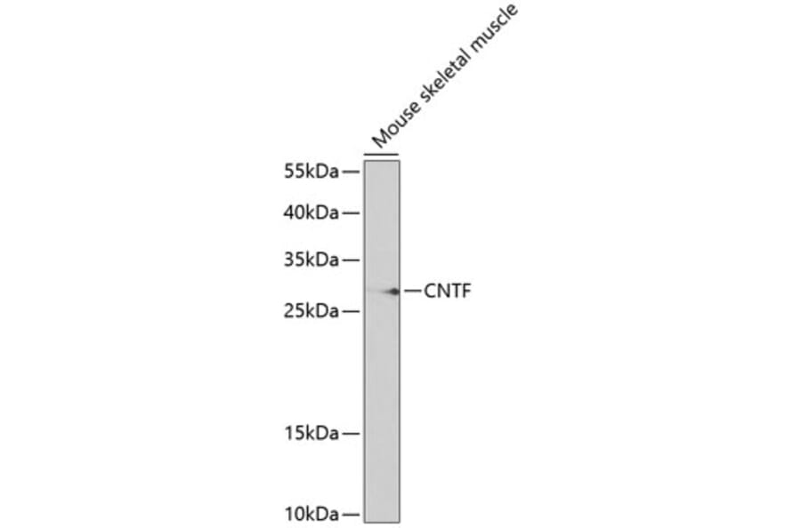 Western Blot - Anti-CNTF Antibody (A13739) - Antibodies.com