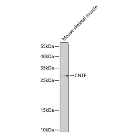 Western Blot - Anti-CNTF Antibody (A13739) - Antibodies.com