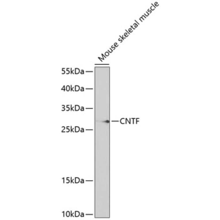 Western Blot - Anti-CNTF Antibody (A13739) - Antibodies.com