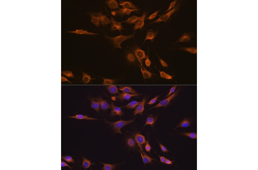 Immunofluorescence - Anti-CNTF Antibody (A13739) - Antibodies.com