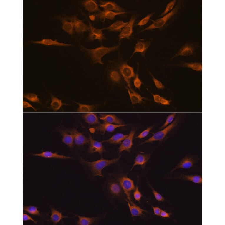 Immunofluorescence - Anti-CNTF Antibody (A13739) - Antibodies.com