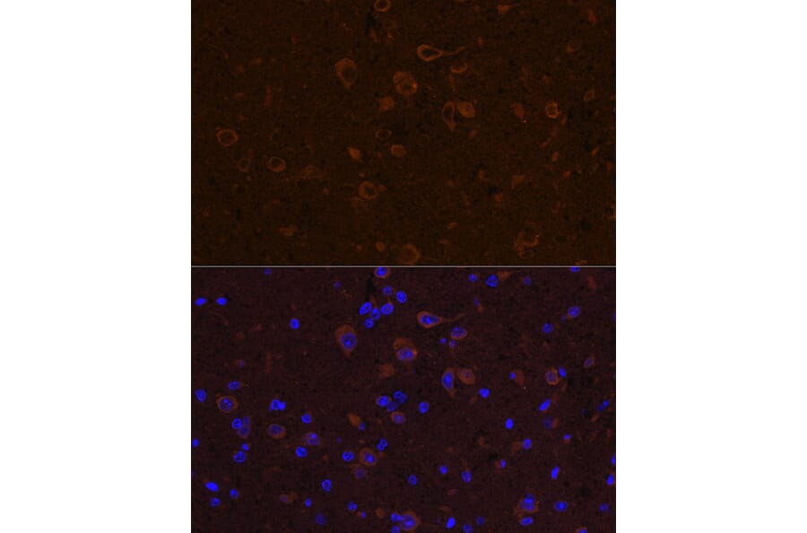 Immunofluorescence - Anti-CNTF Antibody (A13739) - Antibodies.com