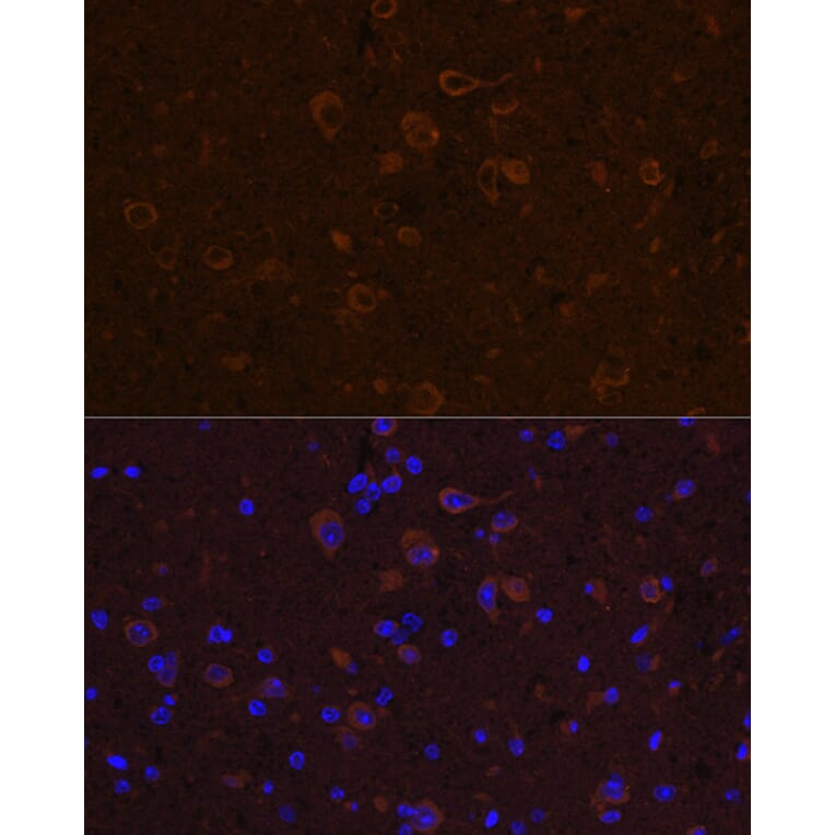 Immunofluorescence - Anti-CNTF Antibody (A13739) - Antibodies.com