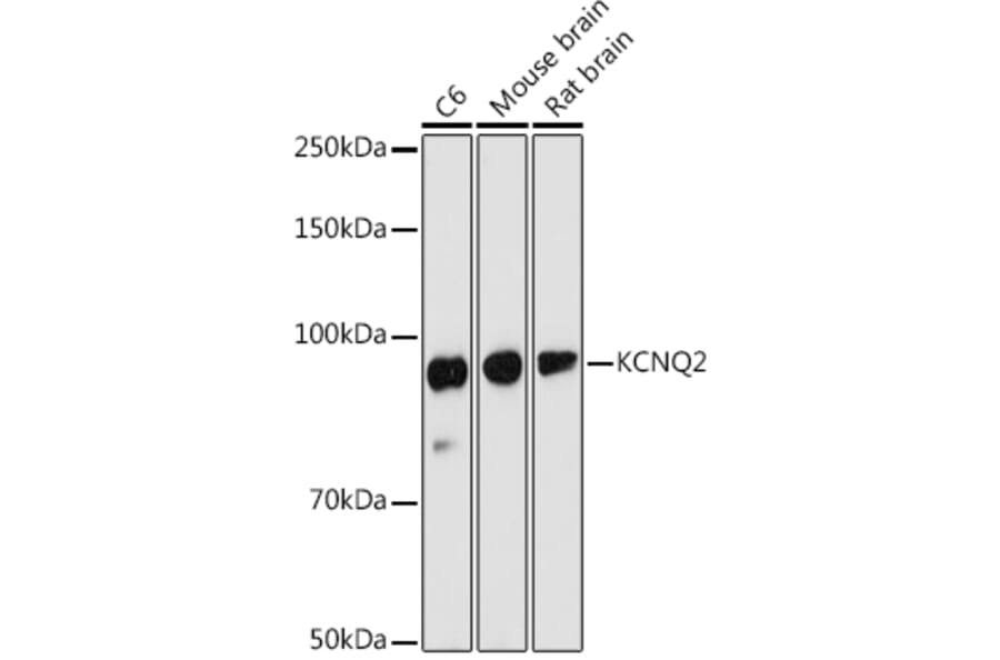 Western Blot - Anti-KCNQ2 Antibody (A13740) - Antibodies.com