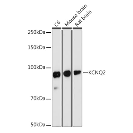 Western Blot - Anti-KCNQ2 Antibody (A13740) - Antibodies.com