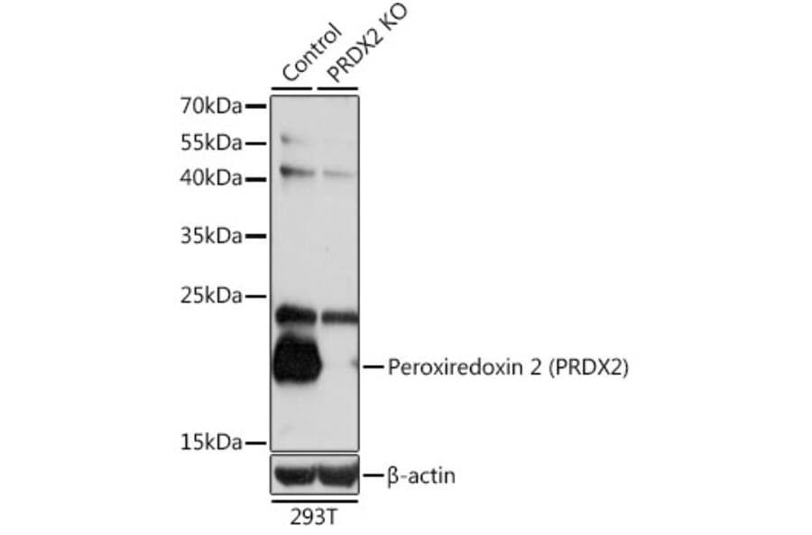 Western Blot - Anti-Peroxiredoxin 2/PRP Antibody (A13742) - Antibodies.com