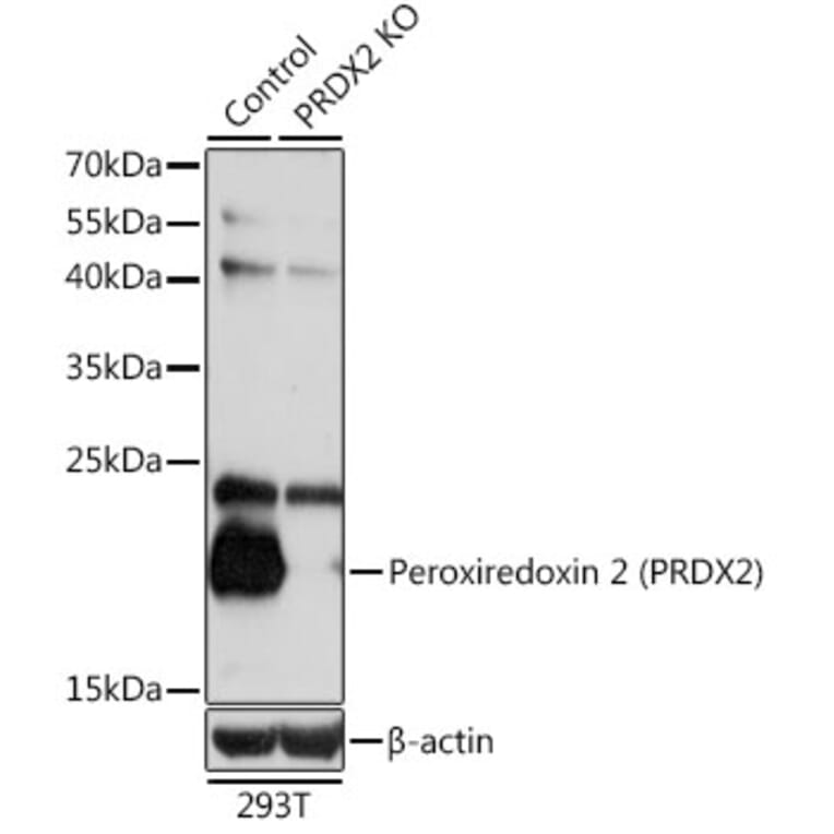 Western Blot - Anti-Peroxiredoxin 2/PRP Antibody (A13742) - Antibodies.com