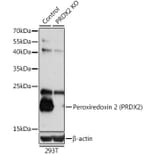 Western Blot - Anti-Peroxiredoxin 2/PRP Antibody (A13742) - Antibodies.com