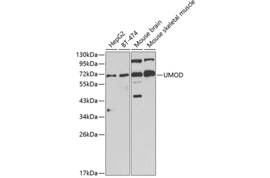 Western Blot - Anti-UMOD Antibody (A1920) - Antibodies.com