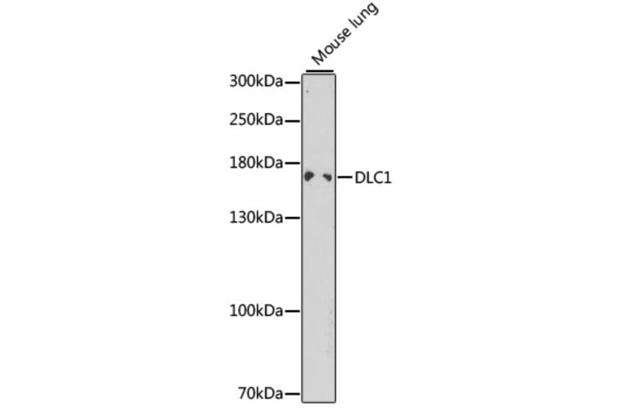 Western Blot - Anti-DLC1 Antibody (A13744) - Antibodies.com