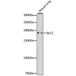 Western Blot - Anti-DLC1 Antibody (A13744) - Antibodies.com