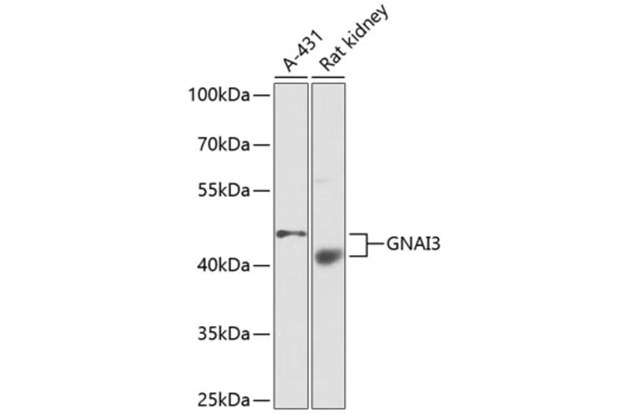 Western Blot - Anti-GNAI3 Antibody (A13745) - Antibodies.com