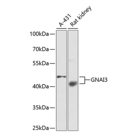 Western Blot - Anti-GNAI3 Antibody (A13745) - Antibodies.com