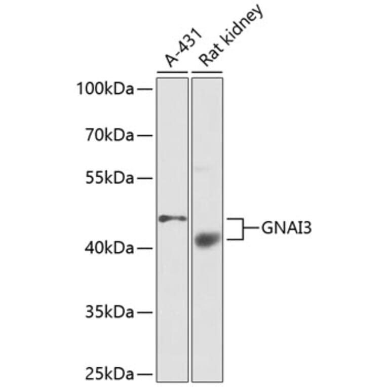 Western Blot - Anti-GNAI3 Antibody (A13745) - Antibodies.com