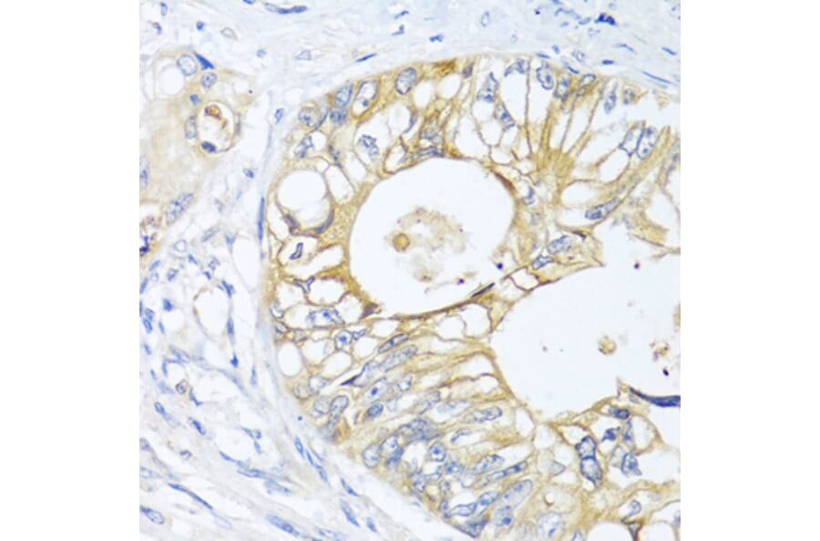 Immunohistochemistry - Anti-GNAI3 Antibody (A13745) - Antibodies.com