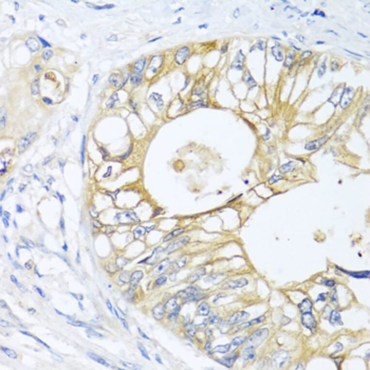 Immunohistochemistry - Anti-GNAI3 Antibody (A13745) - Antibodies.com