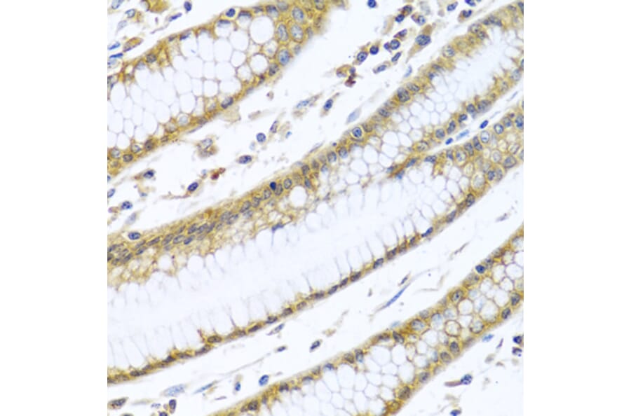 Immunohistochemistry - Anti-GNAI3 Antibody (A13745) - Antibodies.com