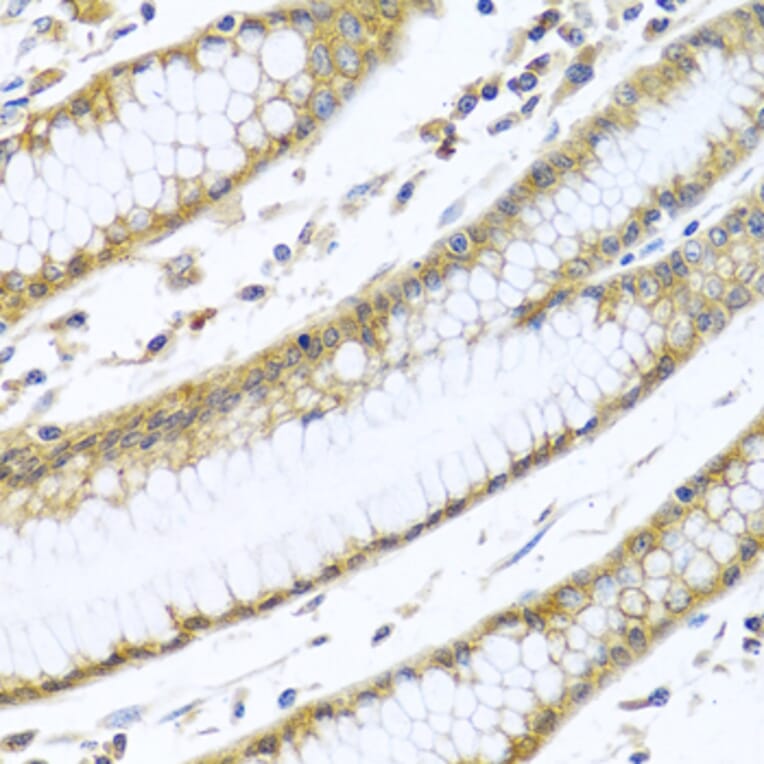 Immunohistochemistry - Anti-GNAI3 Antibody (A13745) - Antibodies.com