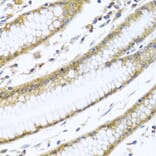 Immunohistochemistry - Anti-GNAI3 Antibody (A13745) - Antibodies.com
