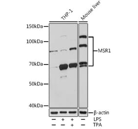 Western Blot - Anti-CD204 Antibody (A13746) - Antibodies.com