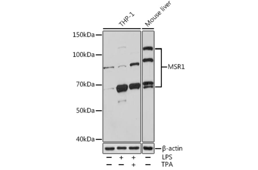 Western Blot - Anti-CD204 Antibody (A13746) - Antibodies.com