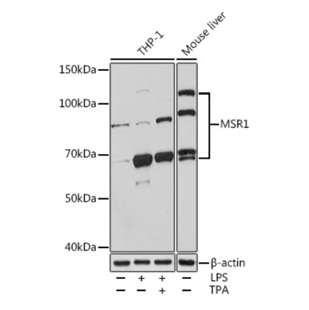 Western Blot - Anti-CD204 Antibody (A13746) - Antibodies.com