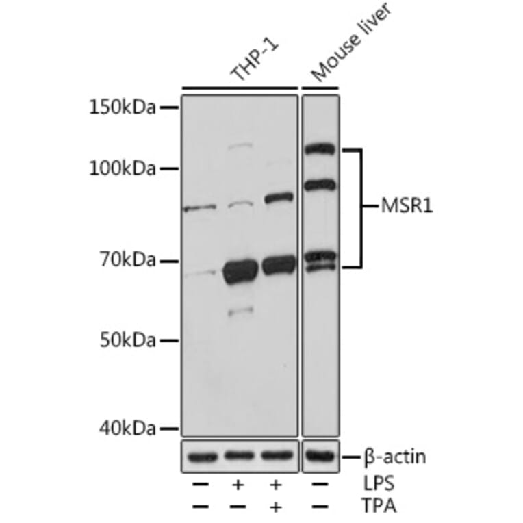 Anti-MSR1 Antibody (A13746) | Antibodies.com