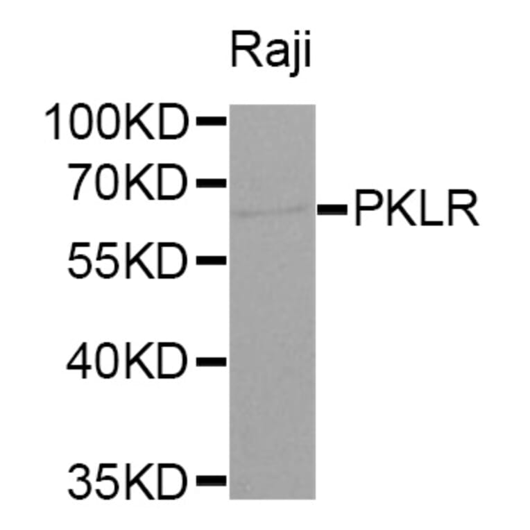Western Blot - Anti-PKLR Antibody (A1924) - Antibodies.com