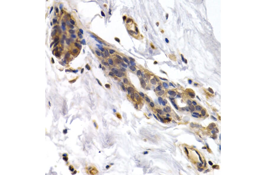 Immunohistochemistry - Anti-PKLR Antibody (A1924) - Antibodies.com